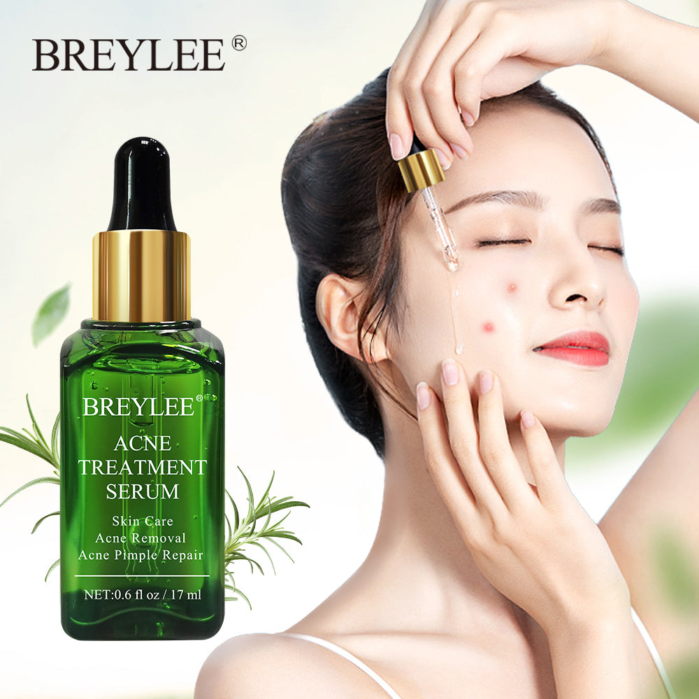 BREYLEE Acne Treatment Face Serum Mask Anti Acne Pimple Scar Remover Moisturizing Whitening Skin Care Facial Essence Cream 17ml - TRIPLE AAA Fashion Collection