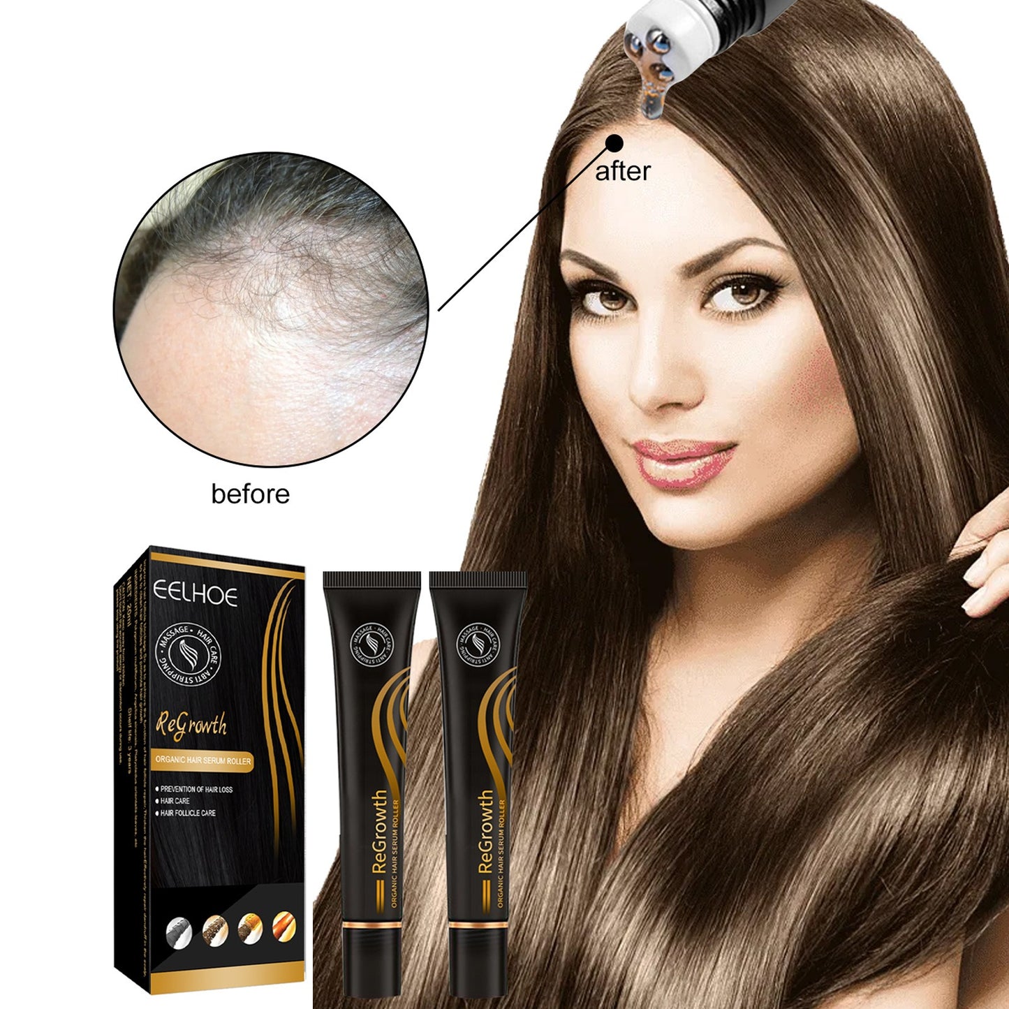 EELHOE Ball Bearing Dense Hair Essential Oil Thick Sparse Hair Bead Massage Scalp Care Fluid To Prevent The Loss Of Essential Oil