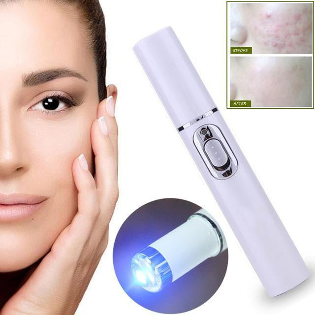 Acne Laser Pen Portable Wrinkle Removal Machine Durable Soft Scar Remover Blue Light Therapy Pen - TRIPLE AAA Fashion Collection