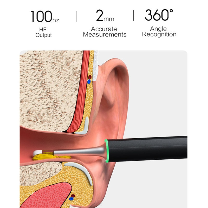 New Bebird X17 Pro Smart Visual Ear Cleaning Endoscope In-Ear 300W Mini Camera Otoscope Borescope 33 in 1 Ear Pick Spoon Tool - TRIPLE AAA Fashion Collection